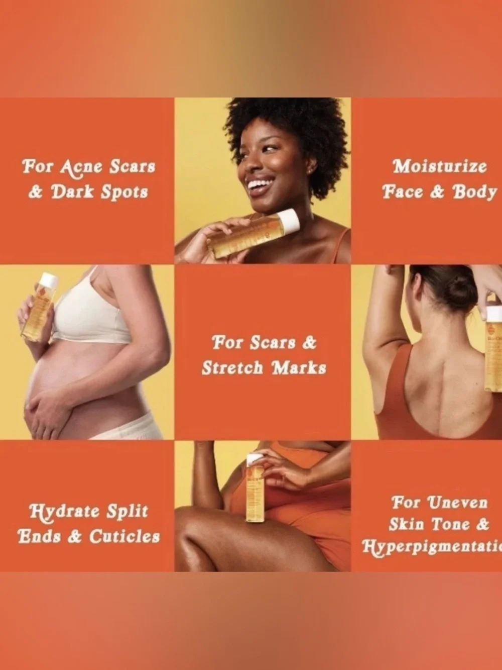 Bio-Oil skincare oil